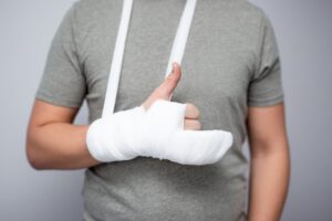 Close-up of a male hand with a bandage and cast, giving a thumbs up, symbolizing health care, injury, and first aid.